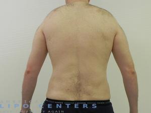 americanlipocenters_112.jpg